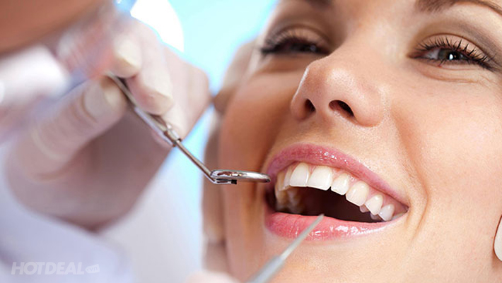 Kết quả hình ảnh cho nha khoa răng hàm mặt hotdeal